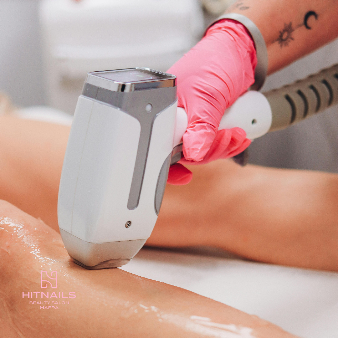 Depilação a laser numa perna, com luvas rosa, no Hit Nails Mafra
